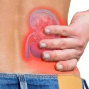 RIRS Treatment for Kidney Stones - Apex Hospital