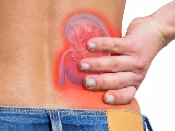 RIRS Treatment for Kidney Stone