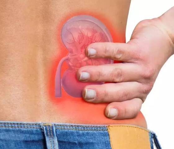 RIRS Treatment for Kidney Stone