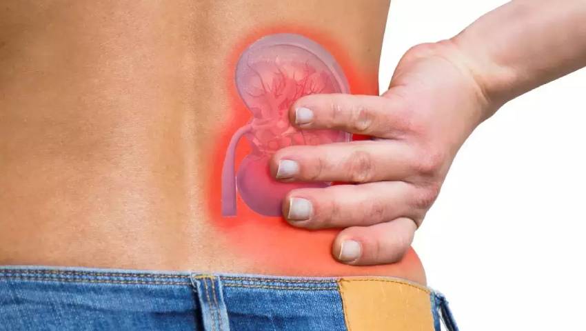 RIRS Treatment for Kidney Stones - Apex Hospital