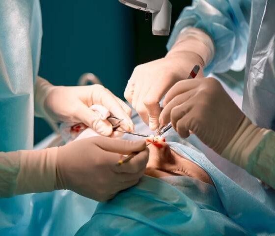 Trauma Surgery – Types, Preparation, Procedure, Risks and Complications